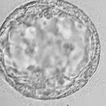 Embryo egg fertilization