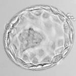 Embryo egg fertilization