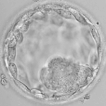 Embryo Grading