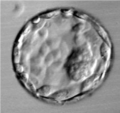 Egg Cell Embryo