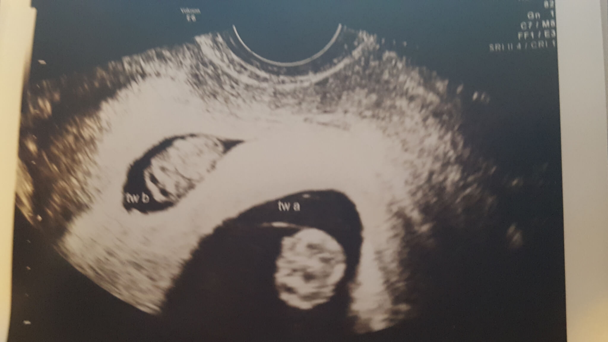 image of heather and brandon's ultrasound